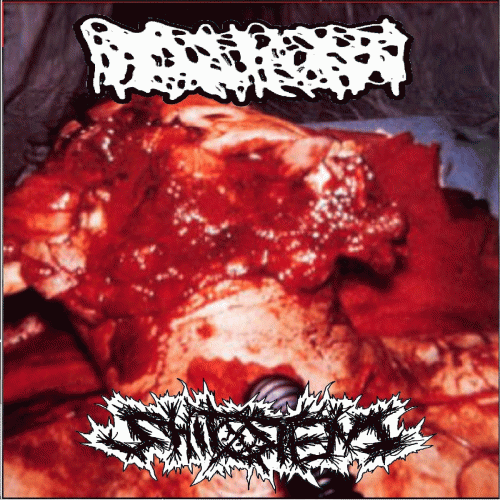 Shitstench : Hydrocephalus - ShitStench Shitstench : Hydrocephalus - ShitStench